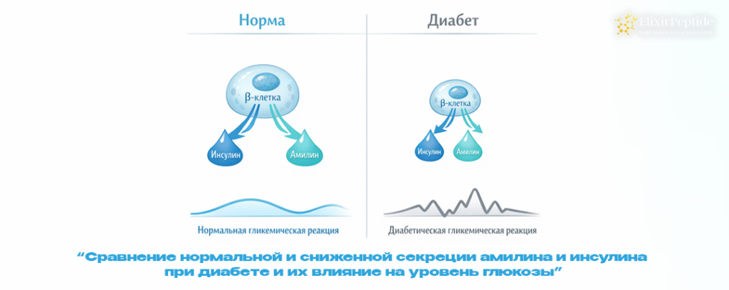 Сравнение нормальной и сниженной секреции амилина и инсулина при диабете и их влияние на уровень глюкозы.png